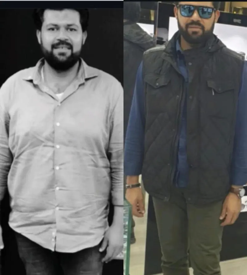 قبل وبعد، عميل، إصابة ركبة